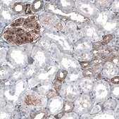 Anti-MYO1B antibody produced in rabbit Prestige Antibodies® Powered by Atlas Antibodies, affinity isolated antibody, buffered aqueous glycerol solution