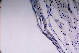 Anti-Sodium Channel Antibody, Voltage Gated, Pan (SP19 Segment) Chemicon®, from rabbit