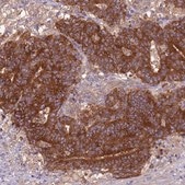 Anti-ARHGAP12 antibody produced in rabbit Prestige Antibodies® Powered by Atlas Antibodies, affinity isolated antibody, buffered aqueous glycerol solution