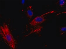 Monoclonal Anti-Fibronectin, Cellular antibody produced in mouse clone FN-3E2, ascites fluid