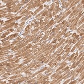 Anti-TFB2M antibody produced in rabbit Prestige Antibodies® Powered by Atlas Antibodies, affinity isolated antibody, buffered aqueous glycerol solution