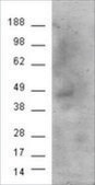 Anti-Cannabinoid receptor 1 antibody produced in goat affinity isolated antibody, buffered aqueous solution