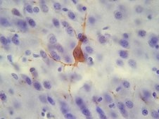 Anti-Substance P Receptor Antibody, pain serum, Chemicon®