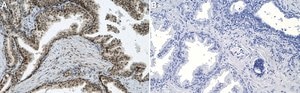Anti-DNA Antibody, double stranded, clone AE-2 clone AE-2, Chemicon®, from mouse