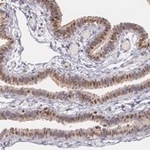 Anti-ATF3 antibody produced in rabbit Prestige Antibodies® Powered by Atlas Antibodies, affinity isolated antibody, buffered aqueous glycerol solution