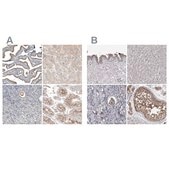 Anti-PCM1 antibody produced in rabbit Prestige Antibodies® Powered by Atlas Antibodies, affinity isolated antibody, buffered aqueous glycerol solution, Ab1