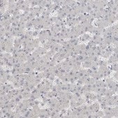 Anti-ADAM2 antibody produced in rabbit Prestige Antibodies® Powered by Atlas Antibodies, affinity isolated antibody, buffered aqueous glycerol solution, Ab2