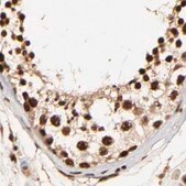 Anti-MED12 antibody produced in rabbit Ab1, Prestige Antibodies® Powered by Atlas Antibodies, affinity isolated antibody, buffered aqueous glycerol solution