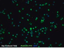 BLaER1 Human B-cell Precursor Leukemia Cell Line BLaER1 human B-cell precursor leukemia cell line may be transdifferentiated and used to model human monocytes.