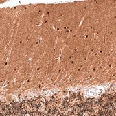 Monoclonal Anti-PTEN antibody produced in mouse Prestige Antibodies® Powered by Atlas Antibodies, clone CL11722, purified immunoglobulin, buffered aqueous glycerol solution