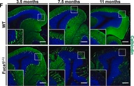 モノクロナール抗カルビンジン-D-28K マウス宿主抗体 clone CB-955, ascites fluid