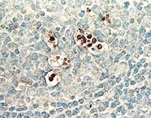 ApopTag Peroxidase In Situ Apoptosis Detection Kit The ApopTag Peroxidase In Situ Apoptosis Detection Kit detects apoptotic cells in situ by labeling &amp; detecting DNA strand breaks by the TUNEL method.