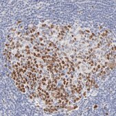 Anti-MCM7 antibody produced in rabbit Prestige Antibodies® Powered by Atlas Antibodies, affinity isolated antibody, buffered aqueous glycerol solution