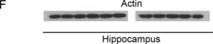 Anti-Actin Antibody, smooth muscle γ &amp; α actin, clone CGA7 ascites fluid, clone CGA7, Chemicon®