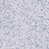 Anti-TAGLN antibody produced in rabbit affinity isolated antibody, buffered aqueous glycerol solution