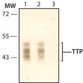 Anti-TTP (N-terminal) antibody produced in rabbit ~1.0 mg/mL, affinity isolated antibody, buffered aqueous solution