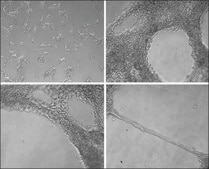 コラーゲン EHS肉腫基底膜由来 Type IV (Miller), lyophilized powder, BioReagent, suitable for cell culture