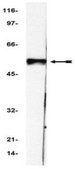 ChIPAb+ p53 - ChIP Validated Antibody and Primer Set from mouse