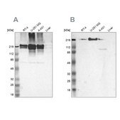 Anti-FLNA antibody produced in rabbit Ab3, Prestige Antibodies® Powered by Atlas Antibodies, affinity isolated antibody, buffered aqueous glycerol solution