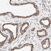 Anti-GOLGB1 antibody produced in rabbit Ab1, Prestige Antibodies® Powered by Atlas Antibodies, affinity isolated antibody, buffered aqueous glycerol solution