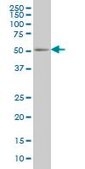 Monoclonal Anti-PEPD antibody produced in mouse clone 1D5-H3, purified immunoglobulin, buffered aqueous solution
