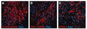 Human Mesenchymal Stem Cells (Bone Marrow) Human mesenchymal stem cells derived from bone marrow that have a capacity for expansion in vitro while maintaining their potential for differentiation to multiple lineages including adipocytes, osteoblasts and chondrocytes.