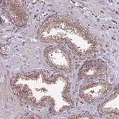 抗GOLGA3抗体 ウサギ宿主抗体 Prestige Antibodies® Powered by Atlas Antibodies, affinity isolated antibody, buffered aqueous glycerol solution