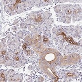 Anti-EPN3 antibody produced in rabbit Prestige Antibodies® Powered by Atlas Antibodies, affinity isolated antibody, buffered aqueous glycerol solution