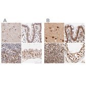Anti-MED12 antibody produced in rabbit Ab2, Prestige Antibodies® Powered by Atlas Antibodies, affinity isolated antibody, buffered aqueous glycerol solution