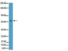 Anti-Tau Antibody, a.a. 210-241, clone Tau-5 ascites fluid, clone Tau-5, Chemicon®