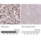 Anti-TXN antibody produced in rabbit Prestige Antibodies® Powered by Atlas Antibodies, affinity isolated antibody, buffered aqueous glycerol solution