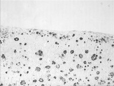 Anti-Amyloid Antibody, β 1-16, clone DE2 culture supernatant, clone DE2, Chemicon®