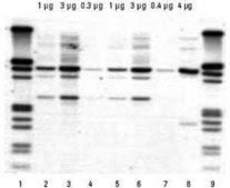 High Pure PCR Template Preparation Kit pkg of 100 purifications, suitable for DNA extraction