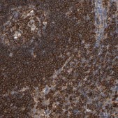 Anti-PLCG2 antibody produced in rabbit Prestige Antibodies® Powered by Atlas Antibodies, affinity isolated antibody, buffered aqueous glycerol solution, Ab2