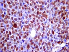 Anti-phospho-BRCA2 (Ser3291) Antibody from rabbit, purified by affinity chromatography