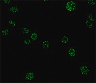 Monoclonal Anti-Splicing Factor SC-35 antibody produced in mouse clone SC-35, ascites fluid