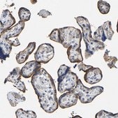 Anti-ACKR2 antibody produced in rabbit Prestige Antibodies® Powered by Atlas Antibodies, affinity isolated antibody, buffered aqueous glycerol solution