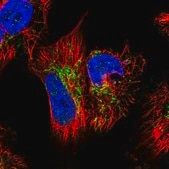 Anti-GTPBP3 antibody produced in rabbit affinity isolated antibody, buffered aqueous glycerol solution