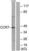 Anti-CCR7 antibody produced in rabbit affinity isolated antibody