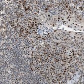 Anti-FBXO44 antibody produced in rabbit Prestige Antibodies® Powered by Atlas Antibodies, affinity isolated antibody, buffered aqueous glycerol solution