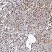 Anti-MRPS15 antibody produced in rabbit Prestige Antibodies® Powered by Atlas Antibodies, affinity isolated antibody, buffered aqueous glycerol solution, ab2