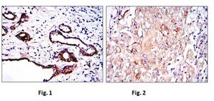Anti-PKN2, clone 1D1 Antibody ascites fluid, clone 1D1, from mouse