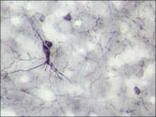 Anti-Neuropeptide Y (NPY) antibody produced in rabbit whole antiserum