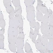 Anti-PSD4 antibody produced in rabbit Prestige Antibodies® Powered by Atlas Antibodies, affinity isolated antibody, buffered aqueous glycerol solution