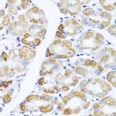 Anti-PIK3CA antibody produced in rabbit