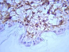 Anti-Rat Collagen Type I Antibody Chemicon®, from rabbit