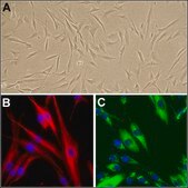 Human Dermal Fibroblasts: HDF, neonatal
