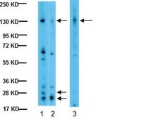 Anti-Integrin alphaV Antibody, CT, Intracellular serum, Chemicon®