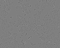 MCF7 Cell Line human NOTE: Both the cell line and DNA from the cell line may be available for this product. Please choose -1VL or VIAL for cells, or -DNA-5UG for DNA, 86012803, human breast (adenocarcinoma), Epithelial-like