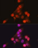 Anti- CDKN2A/p16INK4a antibody produced in rabbit